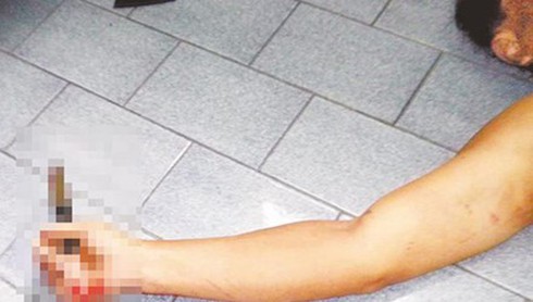 Dùng dao đâm vợ đang ngủ rồi uống thuốc sâu tự tử - ảnh 1