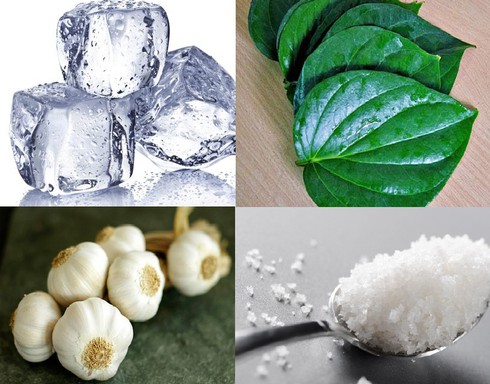 Cách chữa đau răng nhanh, hiệu quả - ảnh 1