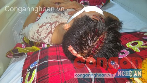 Một nam thanh niên bị khoảng 20 đối tượng đánh hội đồng - ảnh 1