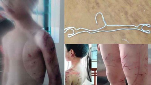 Vụ cha đẻ đánh con tàn nhẫn: Khởi tố, làm rõ nhiều tình tiết - ảnh 1