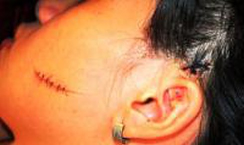 Dùng dao lam rạch mặt người khác - ảnh 1