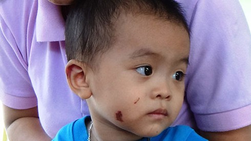 Bé trai 19 tháng tuổi nghi bị đánh bầm dập - ảnh 1