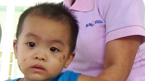 Bé trai 19 tháng tuổi nghi bị đánh bầm dập - ảnh 2