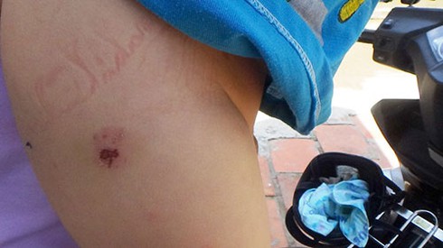 Bé trai 19 tháng tuổi nghi bị đánh bầm dập - ảnh 3
