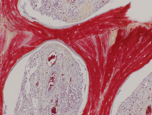 Xương nhân tạo từ tế bào lợn có thể cấy ghép cho người - ảnh 1