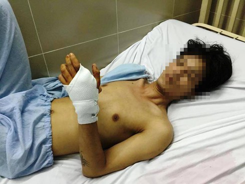 TP.HCM: Đi chơi game, nam thanh niên bị bắn thủng tay - ảnh 2