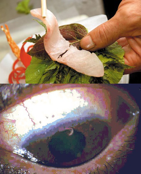 Ăn gỏi cá sống nhiễm giun sán: Vắt chanh, uống rượu cũng vô dụng! - ảnh 1