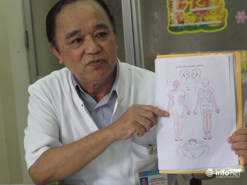 Một sinh viên y khoa bị bỏng nặng trong phòng riêng - ảnh 1