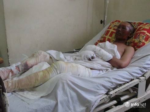 Nổ lò luyện thép, 2 công nhân nhập viện - ảnh 1