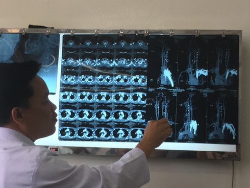 Liên tục bơm máu cứu nạn nhân suýt tử vong vì bị đạn hoa cải bắn - ảnh 1
