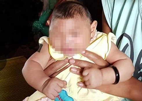 Virus Zika nguy hiểm vì chỉ phát hiện ở cuối thai kỳ - ảnh 1