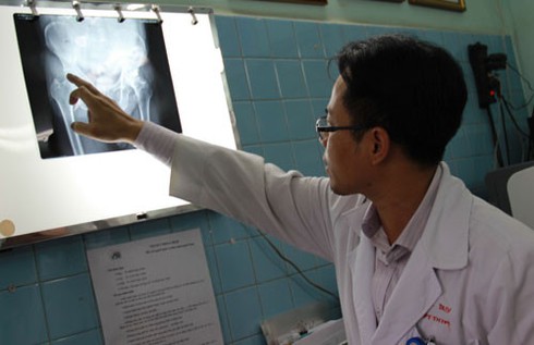 Chân trái bị “hụt” 2cm vì không chịu chữa trị - ảnh 1