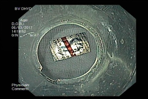 Uống thuốc trị cao huyết áp, nuốt nguyên viên thuốc chưa bóc vỏ - ảnh 2