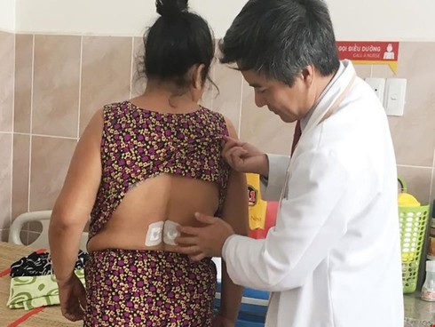 Bắt vít qua da chữa thoát vị đĩa đệm - ảnh 1