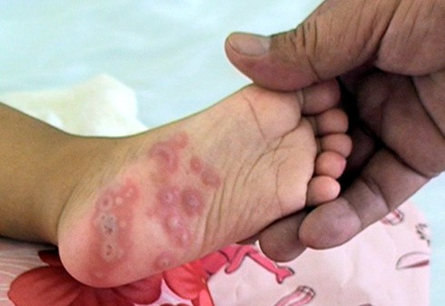 Bệnh nhân điêu đứng vì BHYT đột ngột dừng chi trả nhiều loại thuốc - ảnh 1