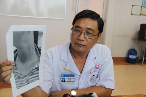 Nhập viện vì dùng mỹ phẩm bôi ngoài da để tiêm làm đẹp - ảnh 1