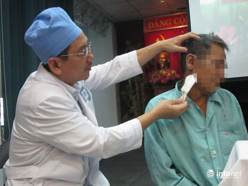 Cây tăm nhang 2cm nằm sâu trong lỗ rò tai cả năm - ảnh 1