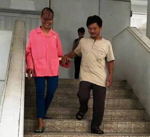 Tìm lại nụ cười cho cô gái 21 năm mang khối bướu trên mặt - ảnh 2