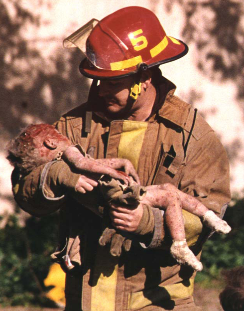 Những bức ảnh chấn động về trẻ em ám ảnh toàn thế giới - ảnh 3