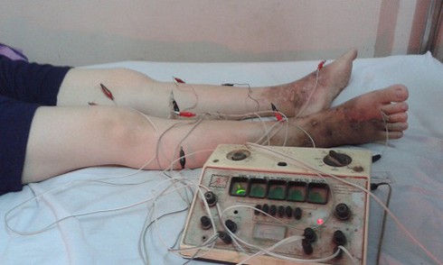 Tìm hiểu phương pháp chữa suy giãn tĩnh mạch chi của lương y Khánh - ảnh 1