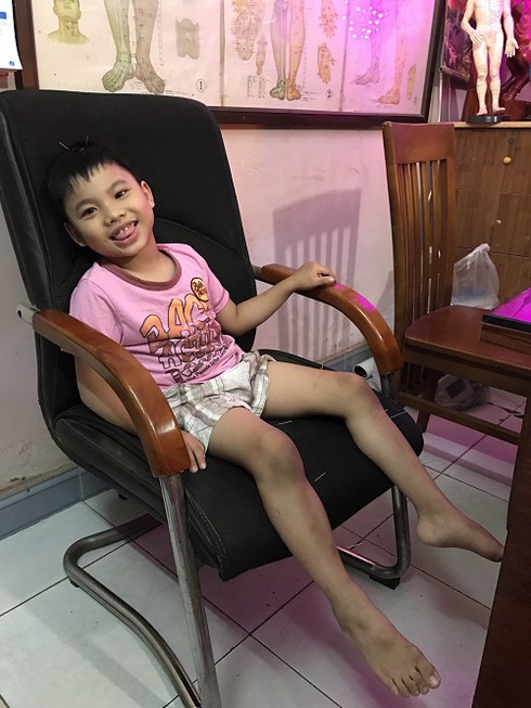 Lương y Phạm Ngọc Khánh: Vị cứu tinh của trẻ bại não - ảnh 1