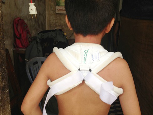 Đà Nẵng: Thanh niên 80kg đánh cháu bé 13 tuổi nứt xương vai? - ảnh 1