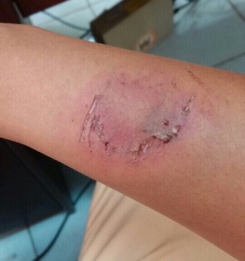 Phạm luật còn quá khích cắn vào tay CSGT - ảnh 1