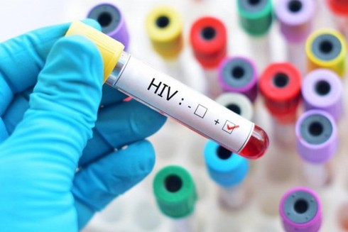 Đột phá: Bệnh nhân nhiễm HIV thứ hai trên thế giới được chữa khỏi - Ảnh 1.