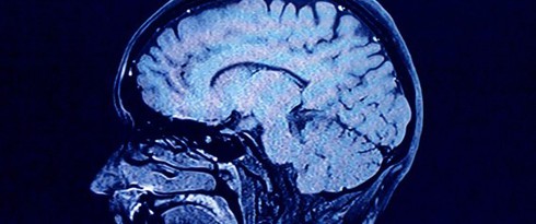 Stress giết chết não như thế nào? - ảnh 1