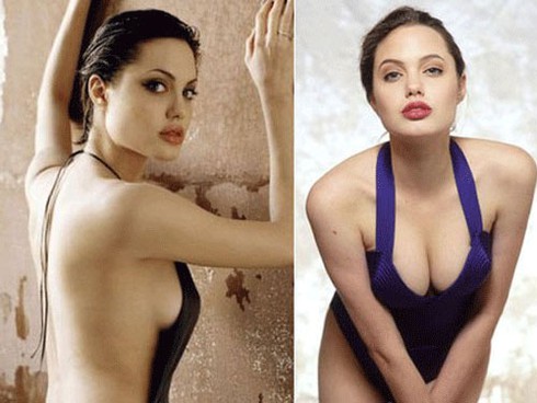 Angelina Jolie cắt ngực: Bác sĩ Việt Nam nhận định gì? - ảnh 1
