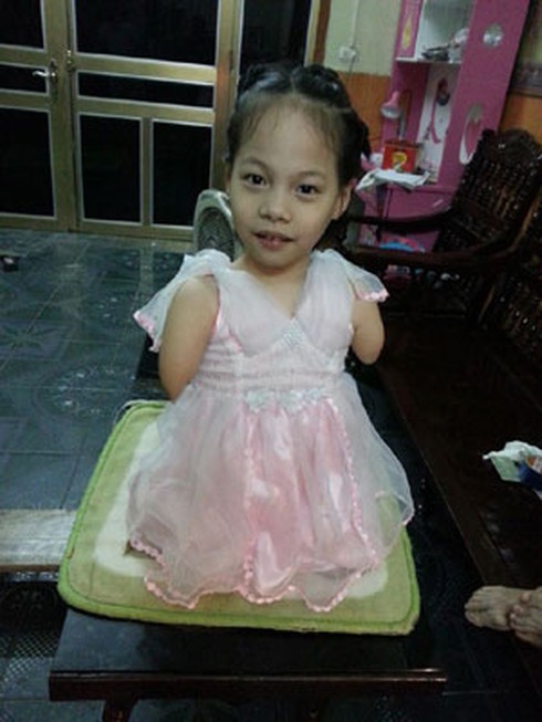 Cô bé không chân tay của Việt Nam - ảnh 1