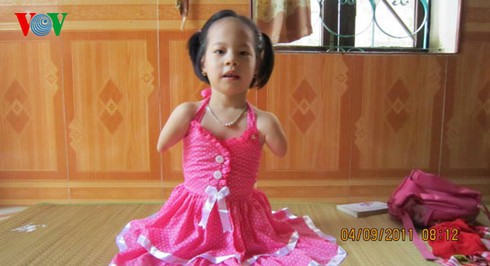 Cô bé không chân tay của Việt Nam - ảnh 3