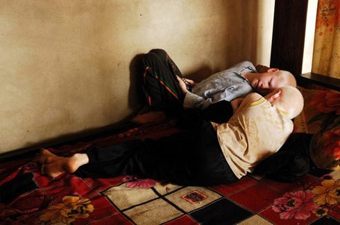 Bộ ảnh độc về cặp song sinh bạch tạng ở Hà Tĩnh - ảnh 2