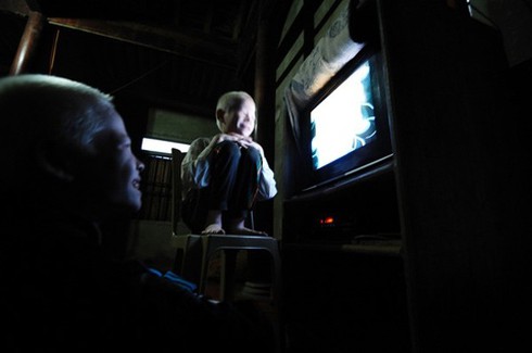 Bộ ảnh độc về cặp song sinh bạch tạng ở Hà Tĩnh - ảnh 11