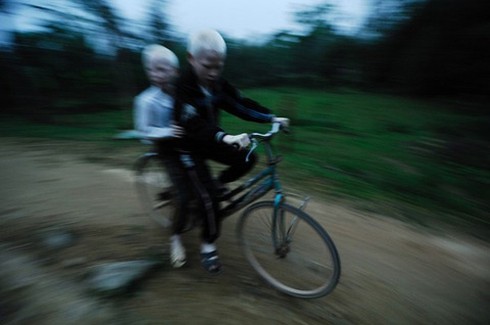 Bộ ảnh độc về cặp song sinh bạch tạng ở Hà Tĩnh - ảnh 12