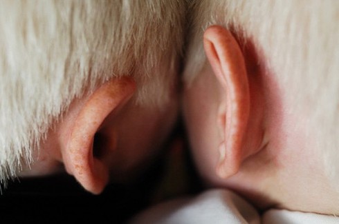 Bộ ảnh độc về cặp song sinh bạch tạng ở Hà Tĩnh - ảnh 13