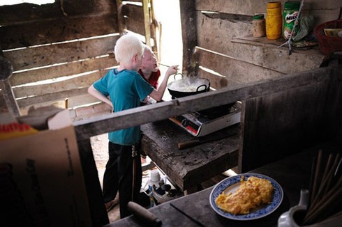 Bộ ảnh độc về cặp song sinh bạch tạng ở Hà Tĩnh - ảnh 18