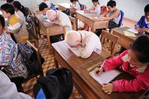 Bộ ảnh độc về cặp song sinh bạch tạng ở Hà Tĩnh - ảnh 21