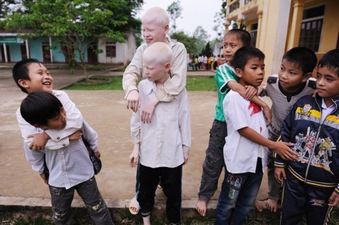 Bộ ảnh độc về cặp song sinh bạch tạng ở Hà Tĩnh - ảnh 22