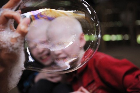 Bộ ảnh độc về cặp song sinh bạch tạng ở Hà Tĩnh - ảnh 23