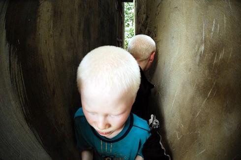 Bộ ảnh độc về cặp song sinh bạch tạng ở Hà Tĩnh - ảnh 24