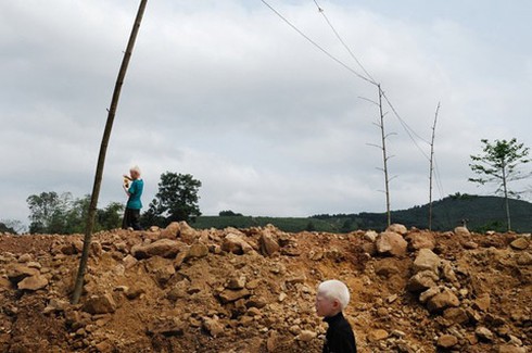 Bộ ảnh độc về cặp song sinh bạch tạng ở Hà Tĩnh - ảnh 4