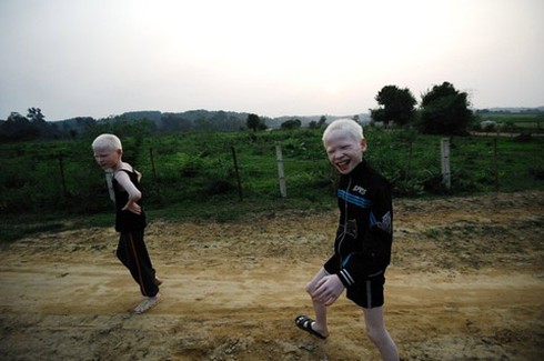 Bộ ảnh độc về cặp song sinh bạch tạng ở Hà Tĩnh - ảnh 5