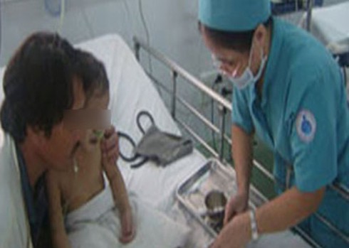 Thích ăn cà rốt, trẻ tím tái toàn thân - ảnh 1
