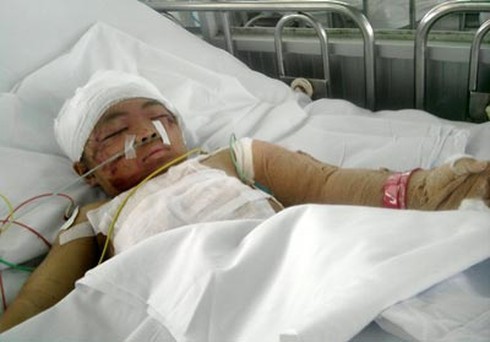 Những chuyện chăm trẻ rùng mình ở mẫu giáo sớm - ảnh 2