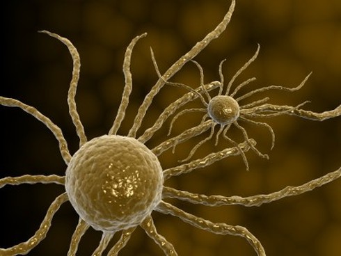 Cách phòng ngừa ung thư cổ tử cung trước và sau quan hệ - ảnh 1