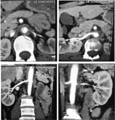 Lý giải ca bệnh “không mạch, không huyết áp” - ảnh 2