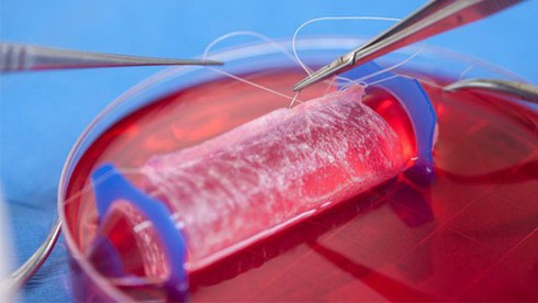 Niềm vui của “thạch nữ” được cấy ghép âm đạo - ảnh 2