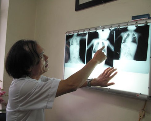 Thêm một bé trai nguy kịch vì hóc thạch - ảnh 1