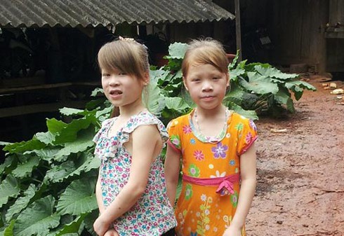 Cha mẹ Việt, hai con gái “giống Tây” như đúc - ảnh 1